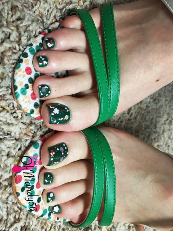 Bright green toe nails with glitter. Pic by ohmandy56