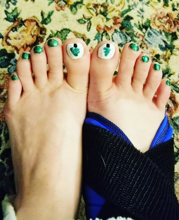 Fabulous green Christmas Toes. Pic by babycakesk