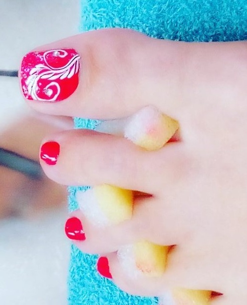 Glam red & white Christmas toe nails. Pic by jillleeward