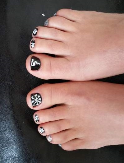In vogue black & white Christmas toes. Pic by jenstoedesign